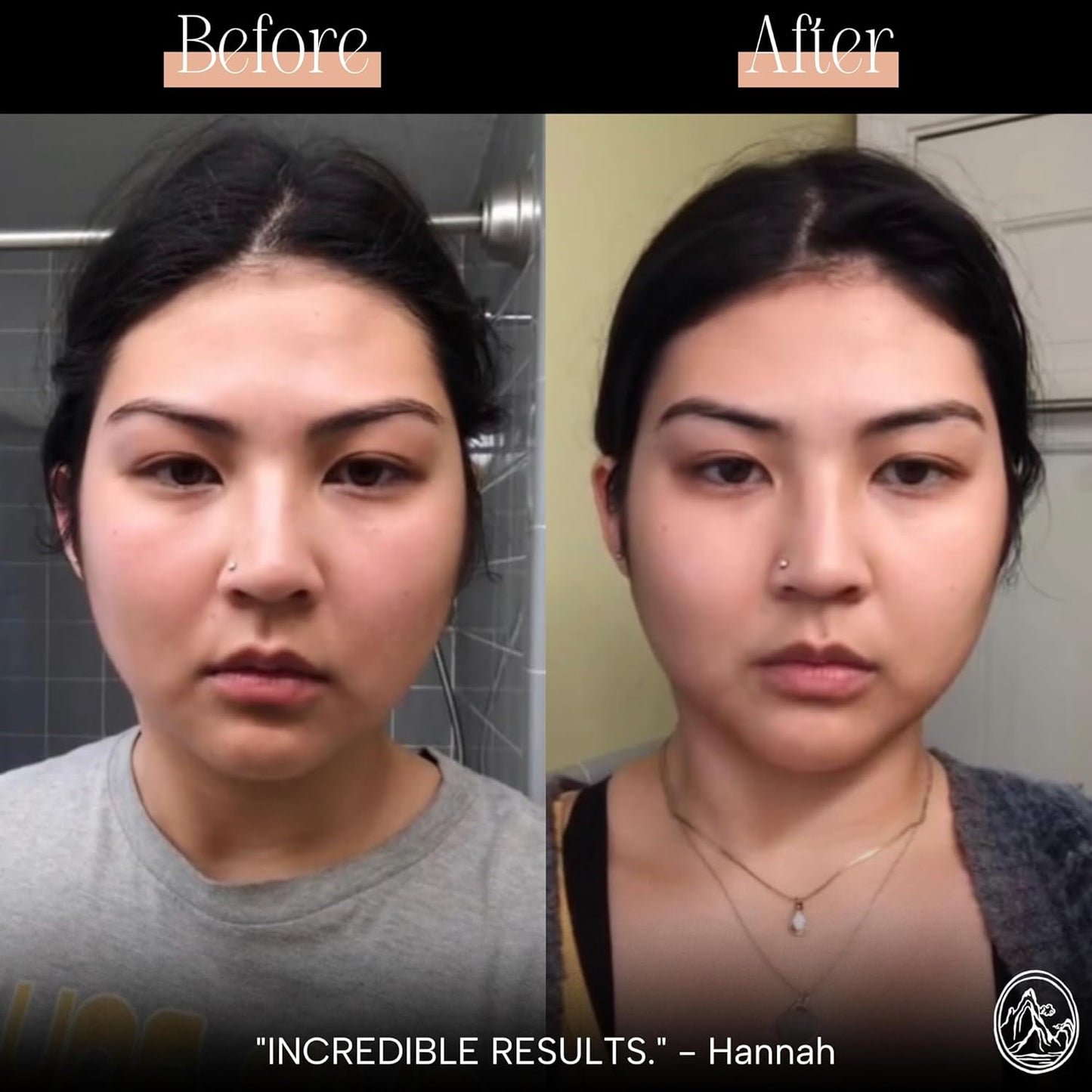 Jade Gua Sha Facial Tool – the Stone of Eternal Youth – 100% Genuine Jade Stone Face Sculpting Tool for Lymphatic Drainage, Puffiness Reduction & Timeless Radiance