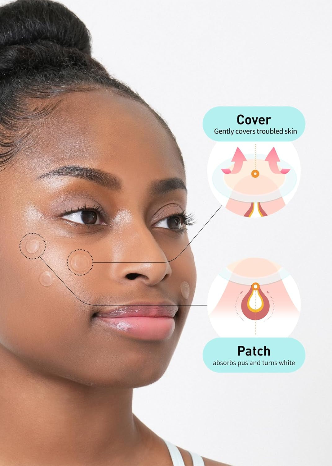 Care plus Spot Patch | Hydrocolloid Acne Korean Spot Patch to Cover Zits, Pimples and Blemishes, for Troubled Skin and Face (Hydrocolloid, 306 Count (Pack of 3))