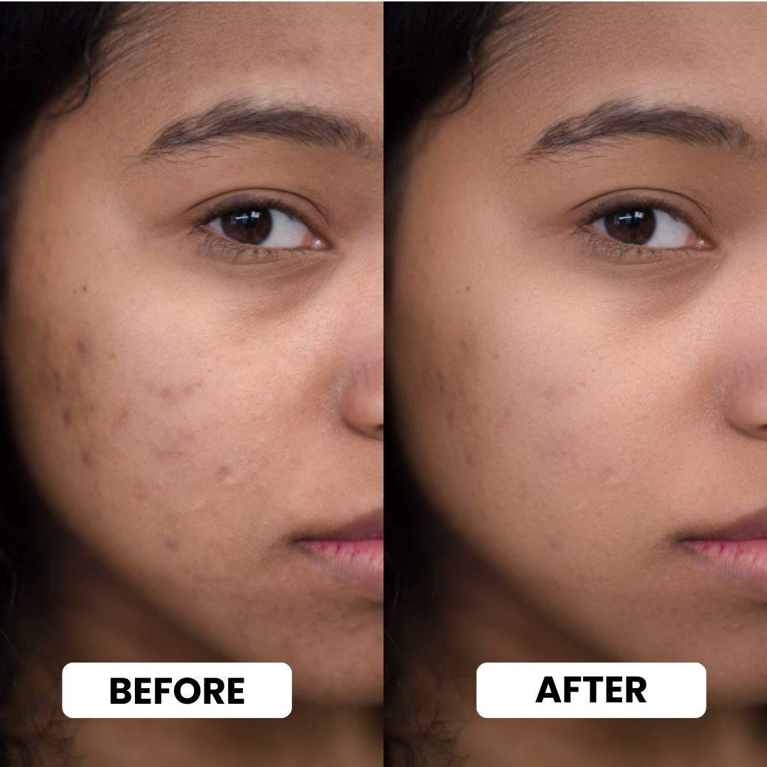 Skin Polish-1